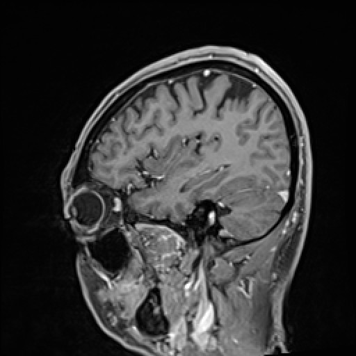 Click on the Serie image to view the images of VILLANUEVA, WILLIAM A.